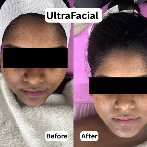 Derma langing page 1