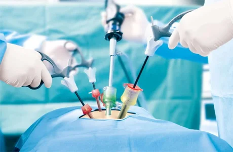 invasive surgery