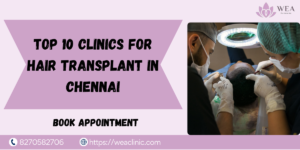 Hair Transplant in Chennai