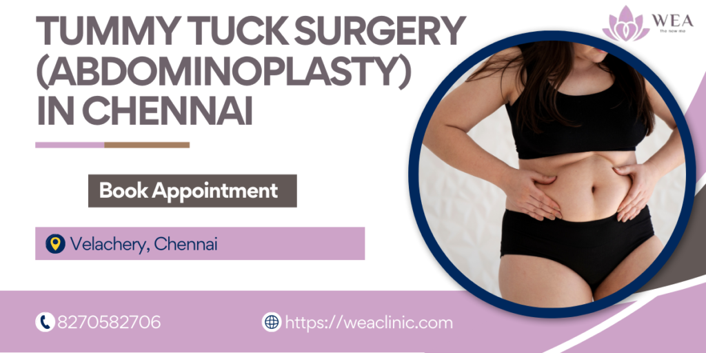 Tummy Tuck Surgery (Abdominoplasty)