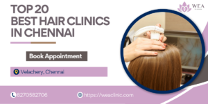 Best hair Clinic in Chennai