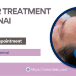 Best PRP hair treatment in Chennai