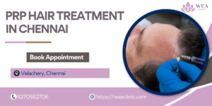 Best PRP hair treatment in Chennai