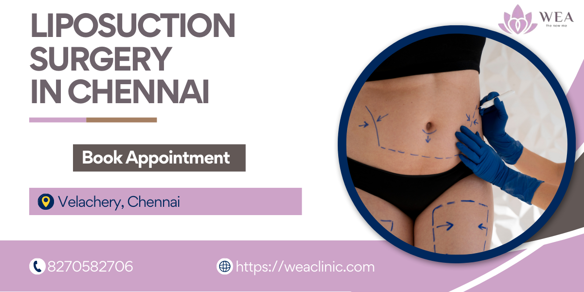 Liposuction Surgery