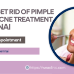 how to get rid of pimple scars and acne treatment in chennai