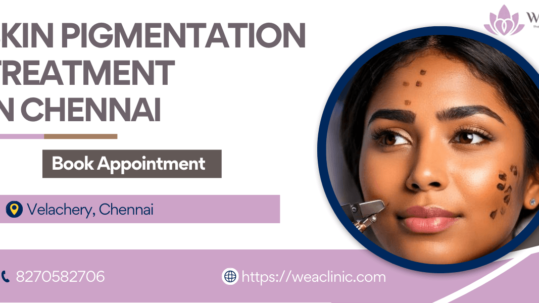 Skin Pigmentation Treatment in Chennai