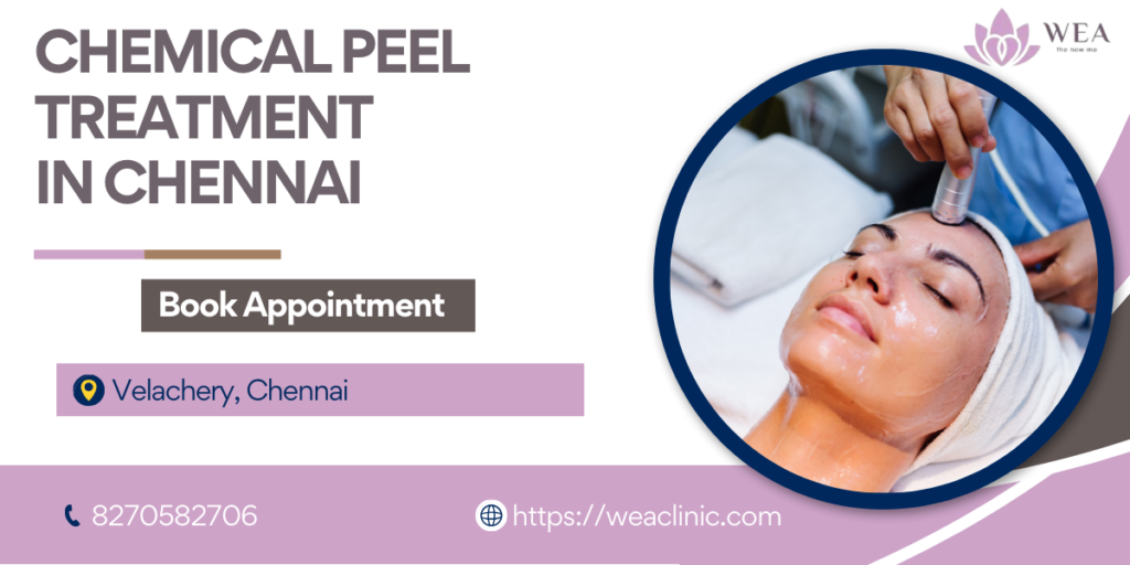 Chemical Peel Treatment