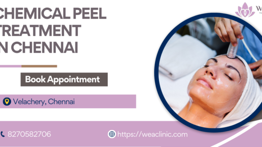 Chemical Peel Treatment