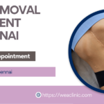 Scar Removal Treatment