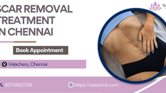 Scar Removal Treatment