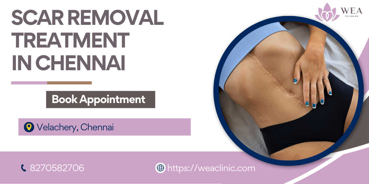 Scar Removal Treatment