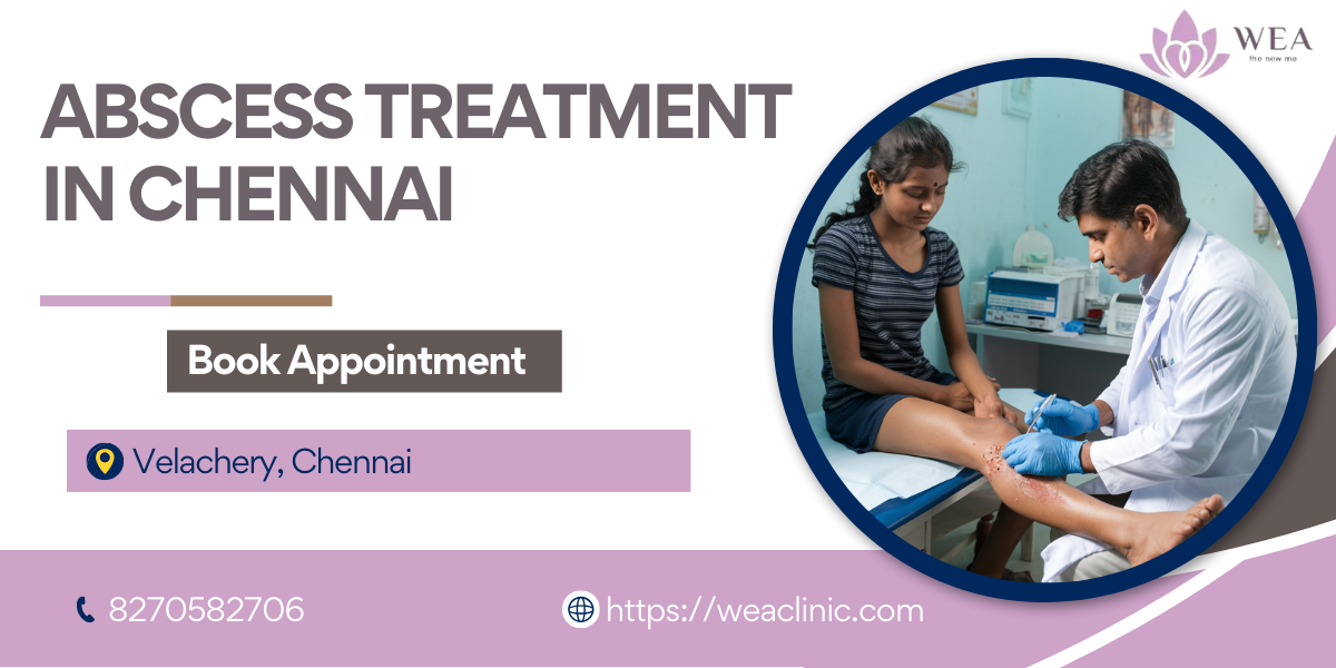 Abscess Treatment In Chennai