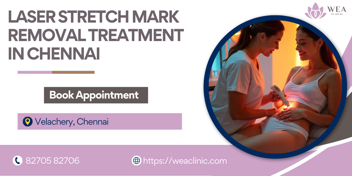 Laser Stretch Marks Removal