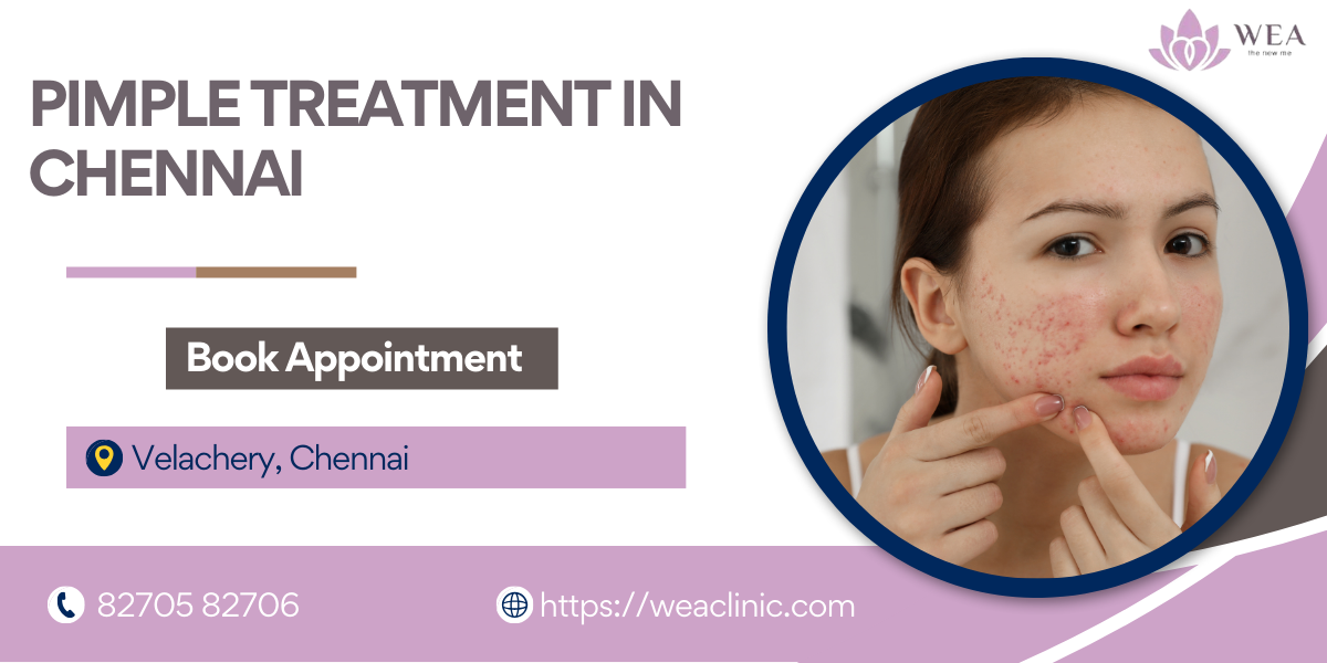 Pimple Treatment in Chennai