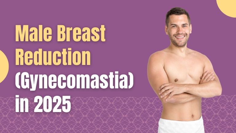 Smiling man after male breast reduction surgery with blog title “Gynecomastia in 2025” on a purple background.
