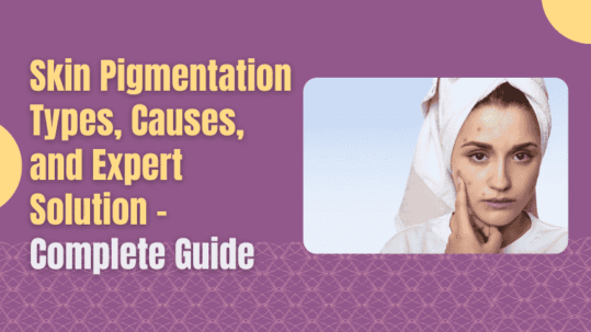 skin pigmentation causes, types and expert solution