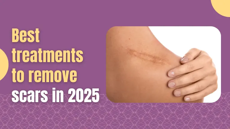 Best treatments to remove scars in 2025