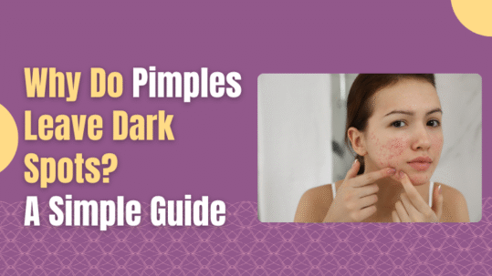 why Pimples Leave Dark Spots?