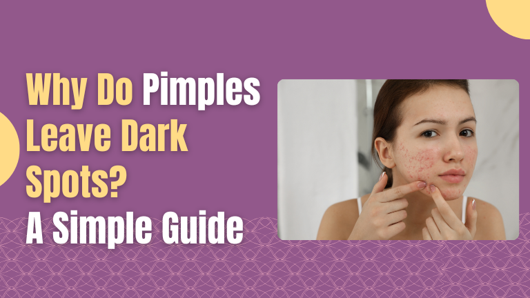 why Pimples Leave Dark Spots?