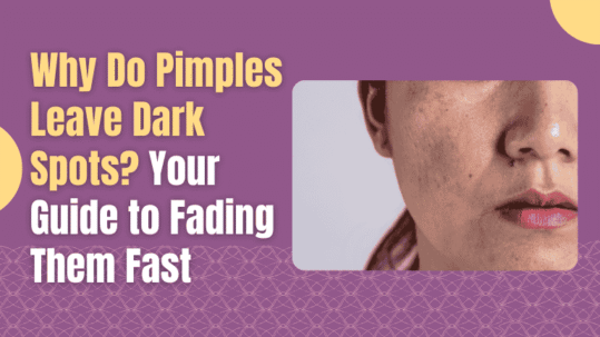 Why Do Pimples Leave Dark Spots?
