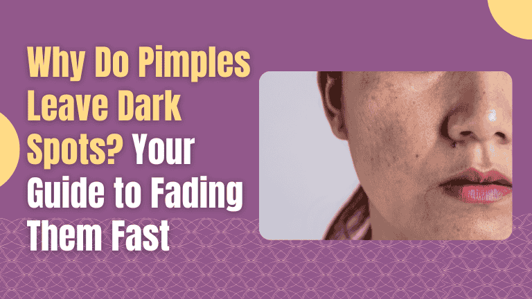 Why Do Pimples Leave Dark Spots?