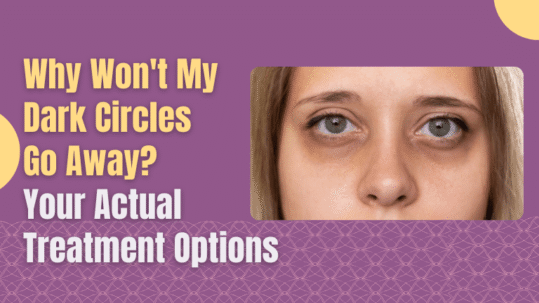Why Won't My Dark Circles Go Away? Your Actual Treatment Options