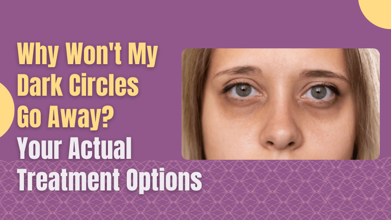 Why Won't My Dark Circles Go Away? Your Actual Treatment Options
