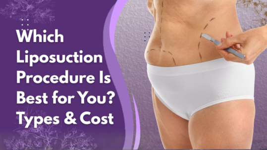 which liposuction procedure is best