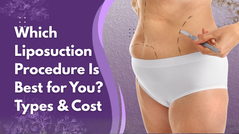 which liposuction procedure is best