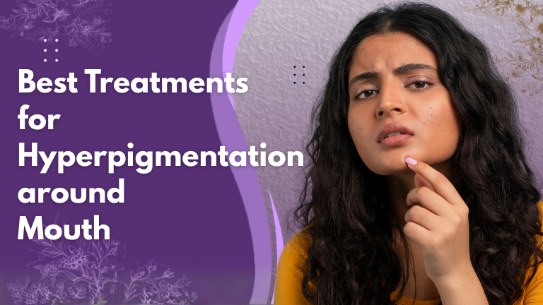 best treatments for hyperpigmentation around mouth
