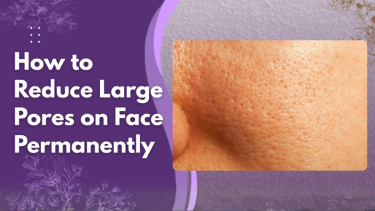 How to Reduce Large Pores on Face Permanently