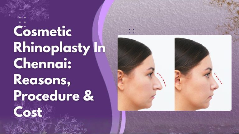 Cosmetic Rhinoplasty In Chennai