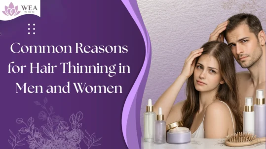 Hair Thinning