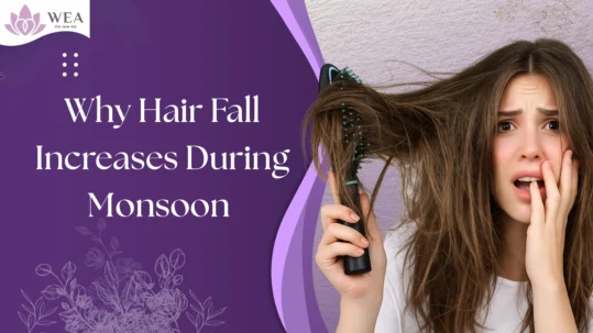Worried woman holding a hairbrush filled with hair, showing excessive hair fall during the monsoon season.