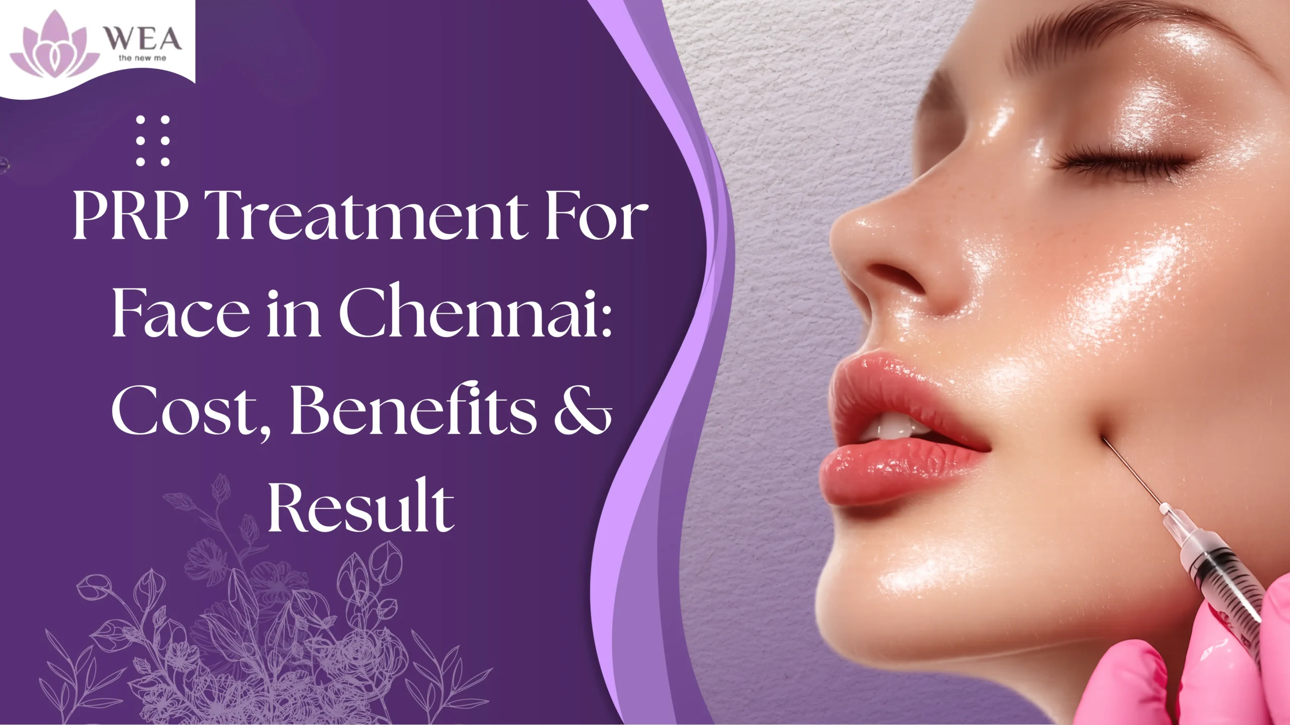 PRP Treatment for Face in Chennai: Cost & Results