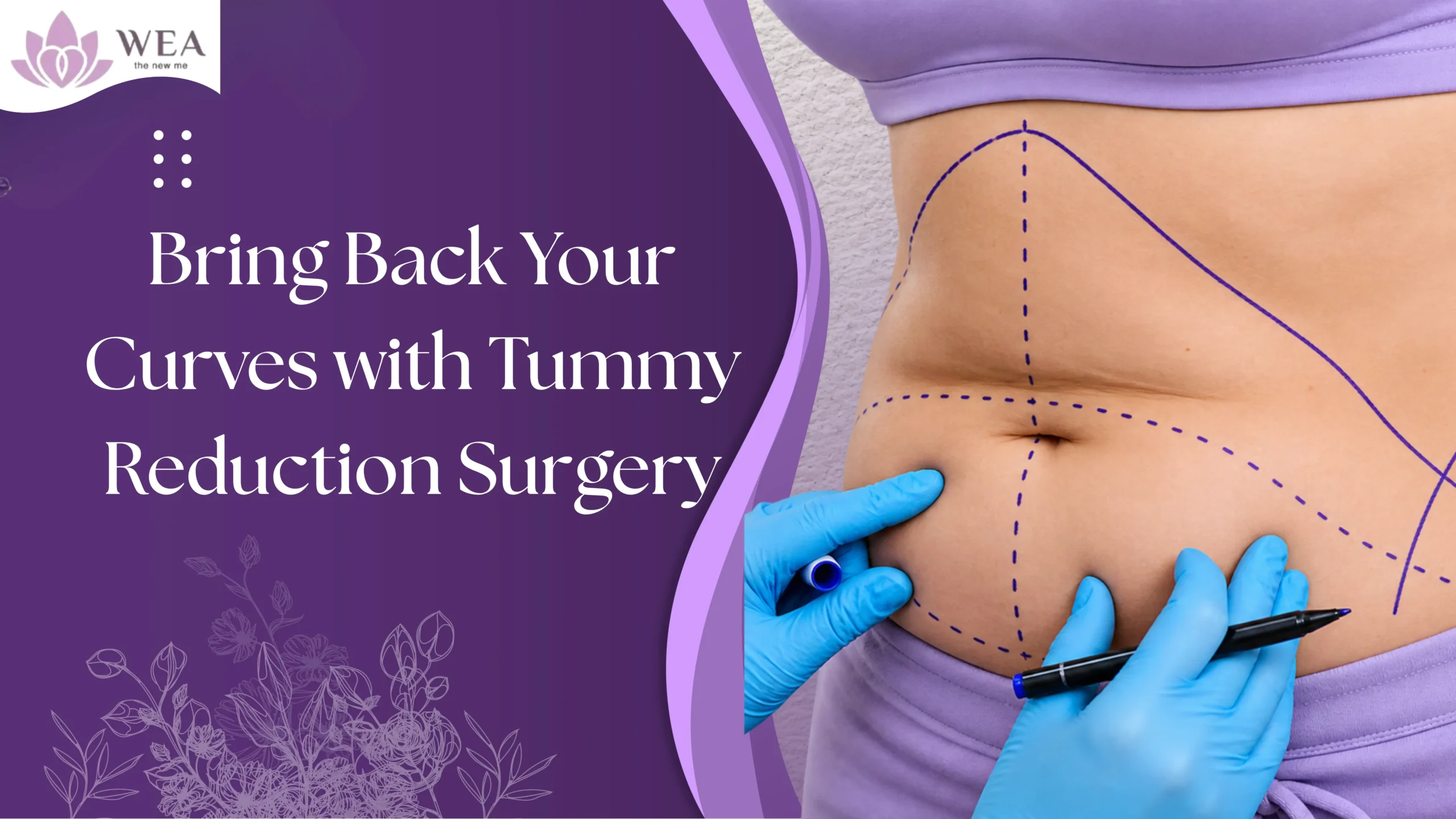 Tummy Reduction Surgery Chennai